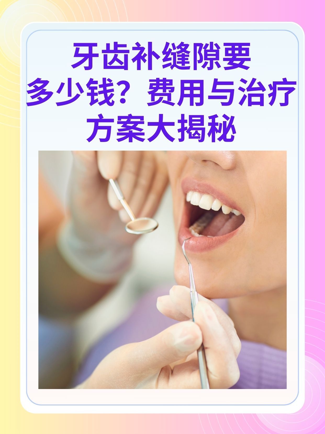 巴彦淖尔补牙医保可以报销吗(补牙医保可以报销吗 哪些可以报销呢)